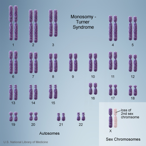 Monosomy.jpg